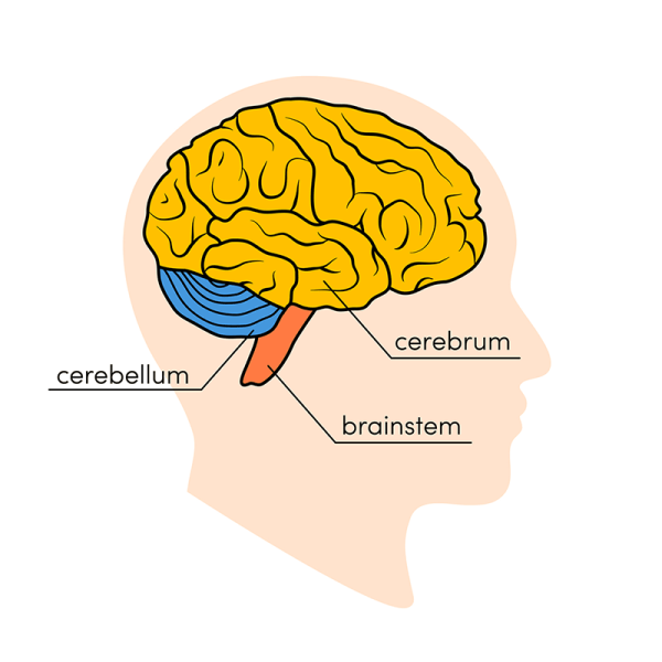 Multiple sclerosis